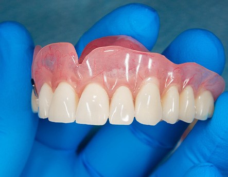 A gloved hand holding a removable upper denture
