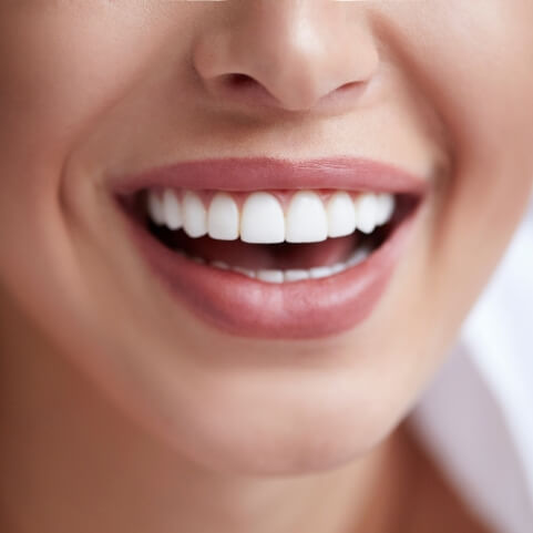 Closeup of flawless smile after cosmetic dentistry