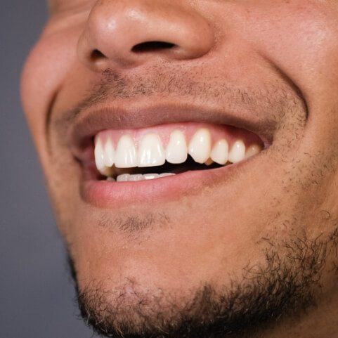 closeup of smile after teeth whitening