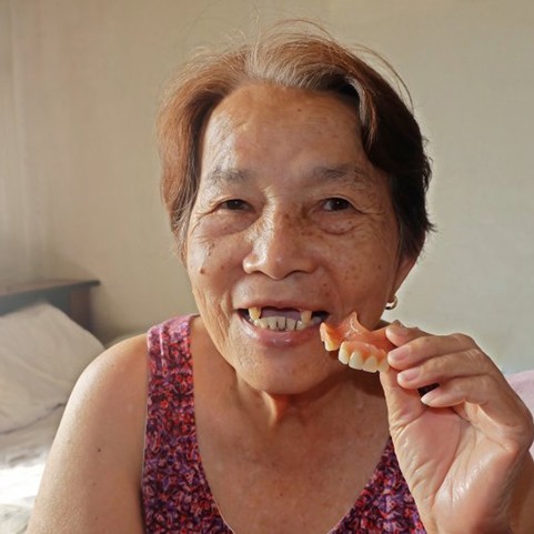 Lady shows her denture