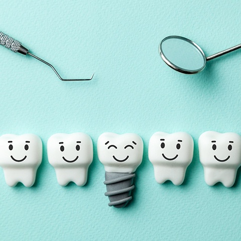 Illustration of dental implant