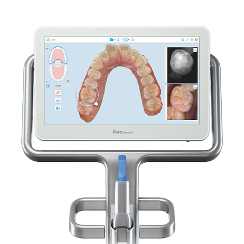 iTero Scanner