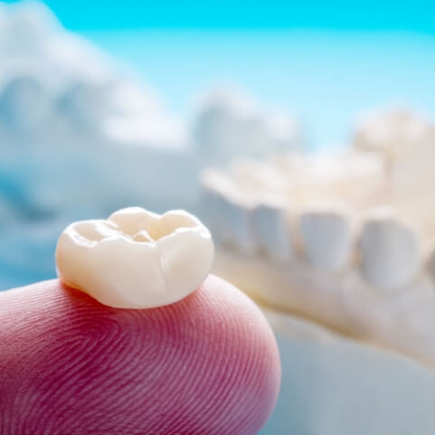 Dental crown resting on fingertip