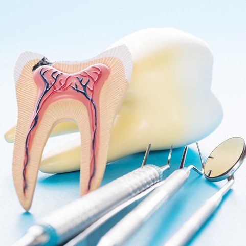 model of the inside of a tooth with dental instruments