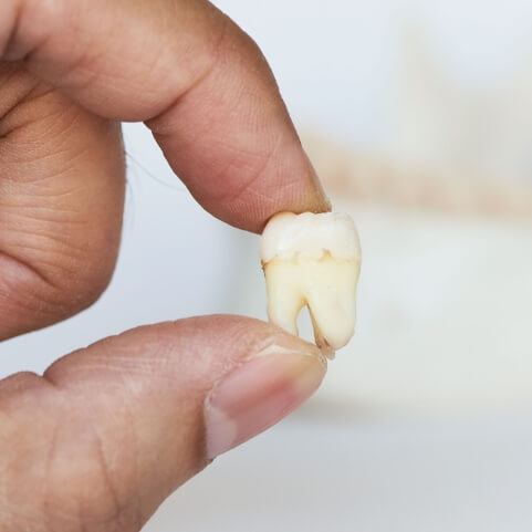 Dentist holding wisdom tooth after extraction