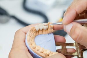 Model of dental bridge.